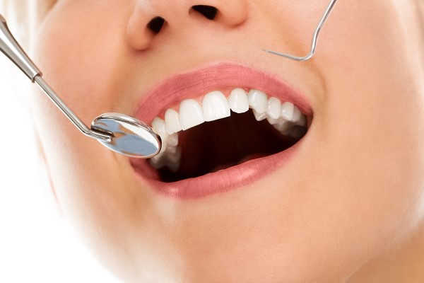 Getting A Thorough Cleaning At Your Dental Checkup