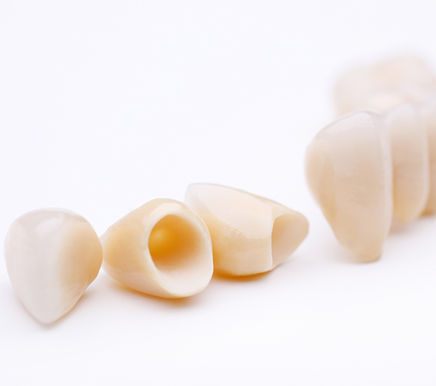 Grand Blanc Dental Crowns and Dental Bridges