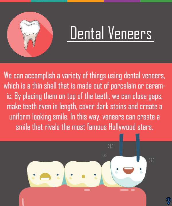 Dental Veneers and Dental Laminates Grand Blanc, MI