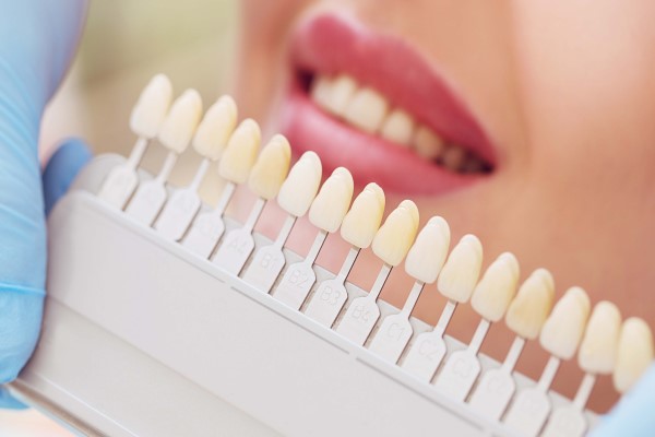 dental veneers Grand Blanc, MI