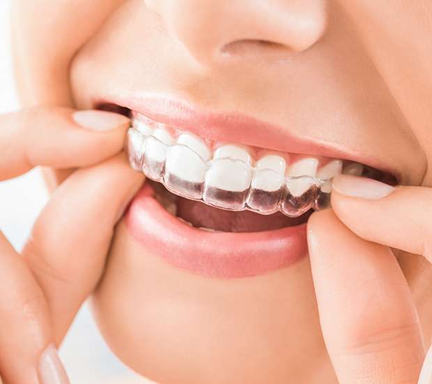 Grand Blanc Does Invisalign Really Work