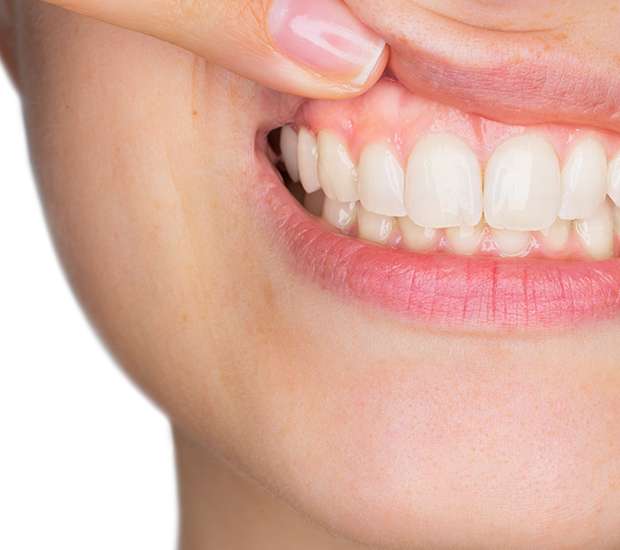 Grand Blanc Gum Disease