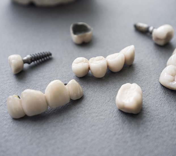 Grand Blanc The Difference Between Dental Implants and Mini Dental Implants