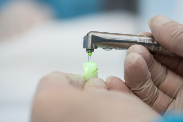 How A Laser Dentist Can Improve Your Smile
