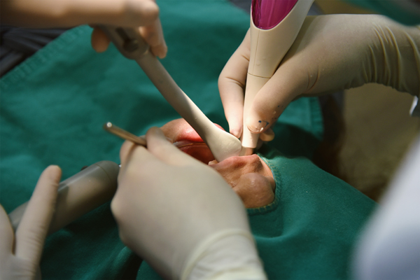 Oral Surgery Options From A General Dentist